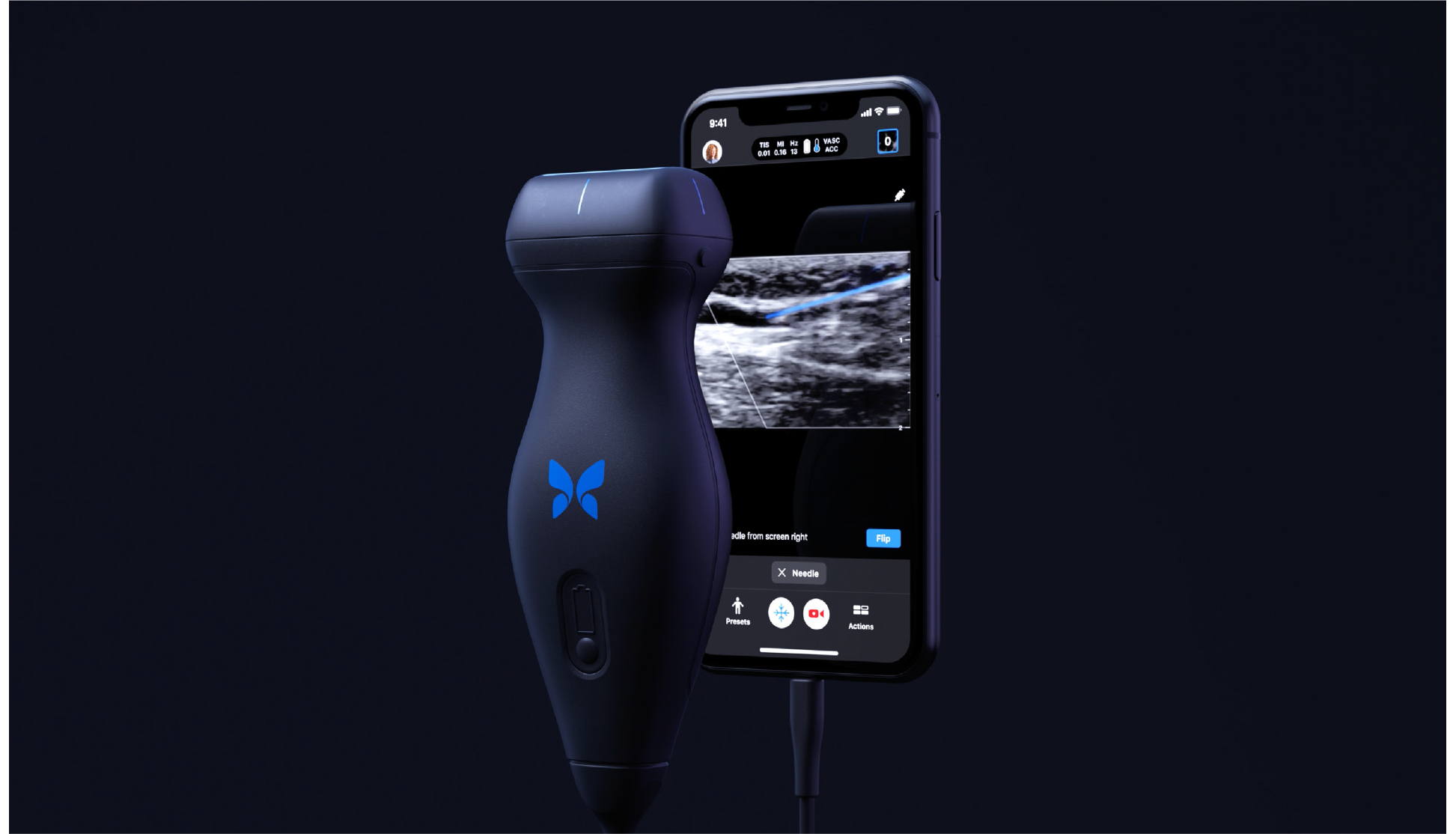 Butterfly IQ - Medical Device Technologies